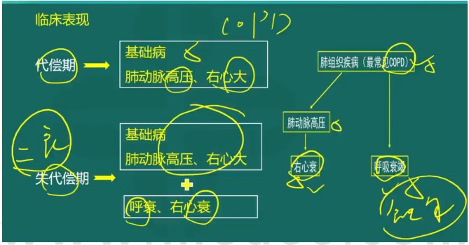 慢性肺源性心臟病臨床表現(xiàn)